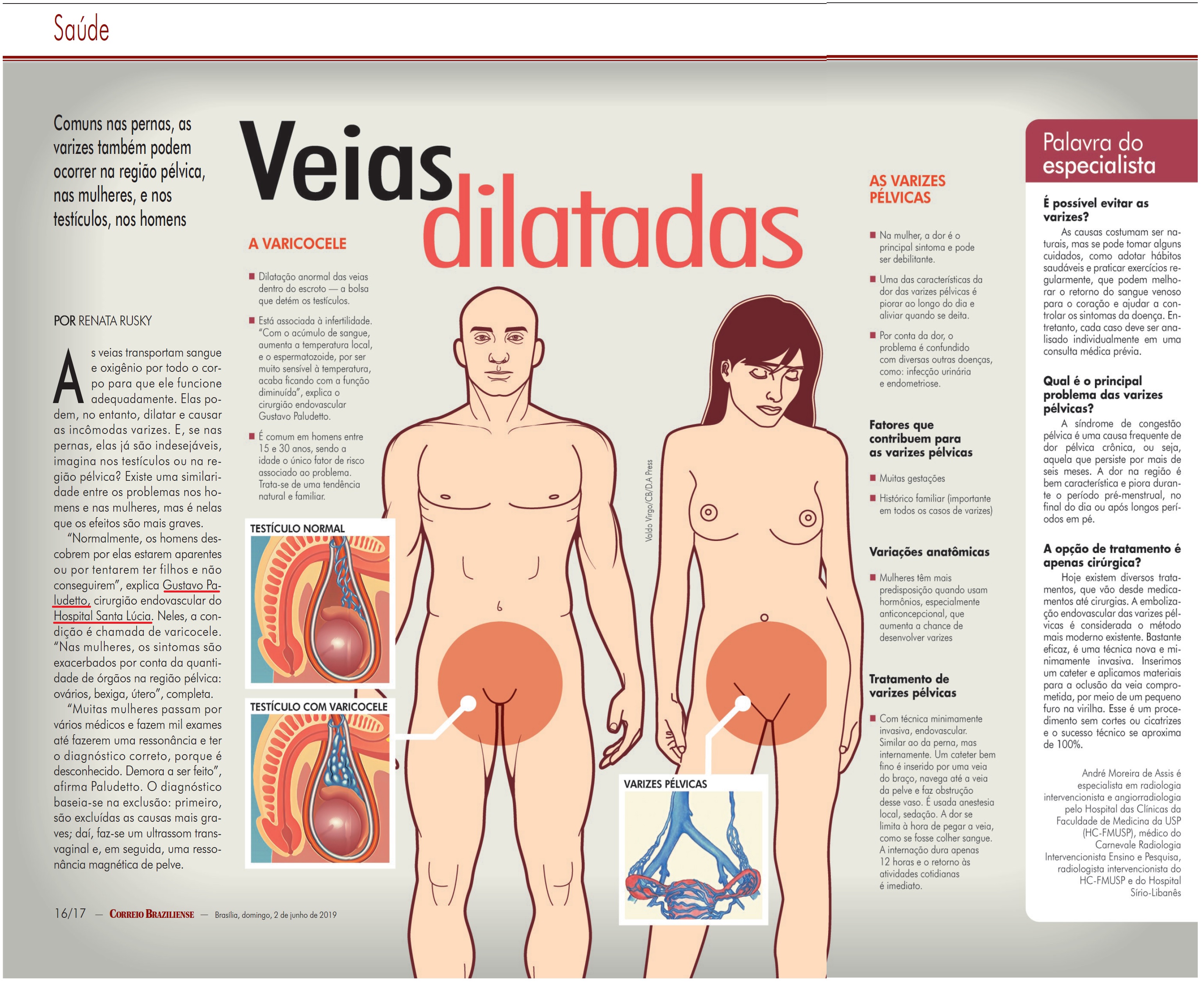 Revista do Correio - Dr. Gustavo Paludetto HSLS - 03-06-2019